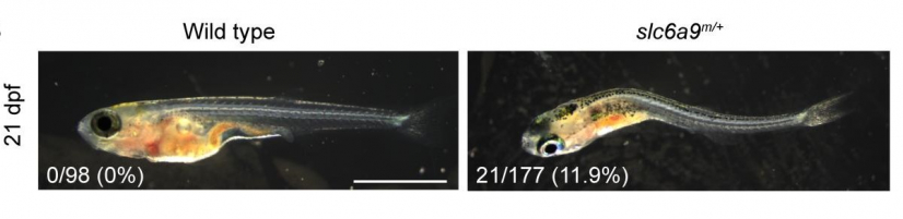 在港大醫學院研究中，突變斑馬魚表現出脊柱彎曲和神經活動不協調，與 AIS 患者的症狀相似，顯示出SLC6A9為青少年原發性脊柱側彎主要成因。

 